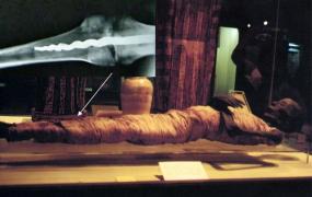 Современные медицинские технологии в Древнем Египте