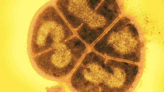 Бактерии Deinococcus radiodurans.