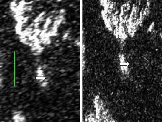 Снимки, сделанные "Кассини" во время разных облетов Титана: слева – T25, справа – T28.