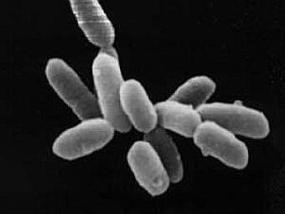 У большинства микроорганизмов оказался общий наземный предок