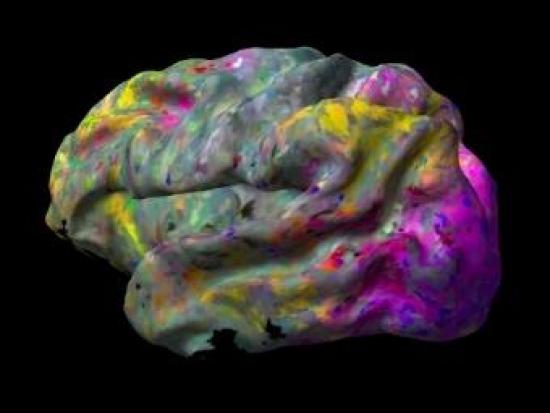 Функциональная МРТ мозга, Фиолетовым ...