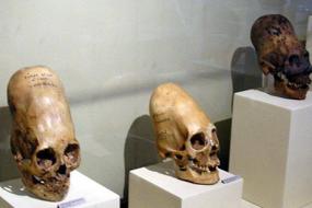 Три новых удлиненных черепа обнаружили в Антарктиде